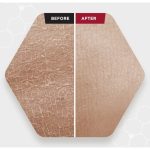 سرم پیلینگ و لایه بردار قوی زامبی بلادی اسکین skin 1004 - Image 3